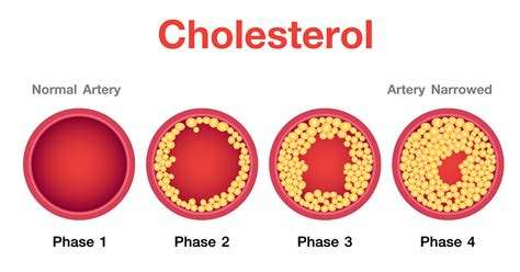 cholesterol definition